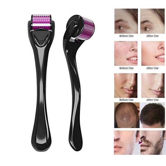 Pack of 2 FEG Hair Growth Spray Plus Derma Roller, Suitable For Both Men and Women.